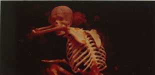 Red Skeleton